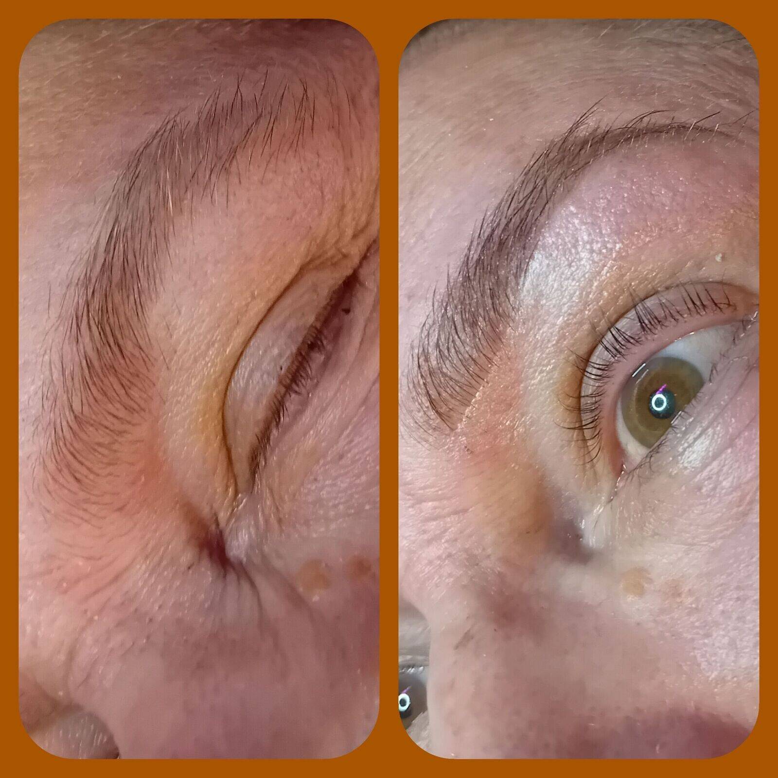 Brow reshape 