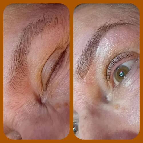 Brow reshape 