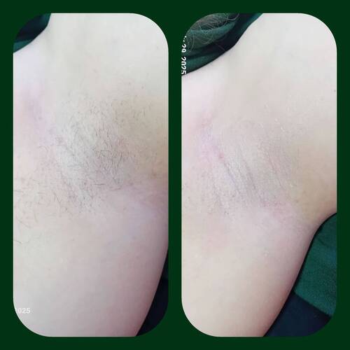 Underarm wax 