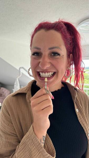 Zahnbleaching