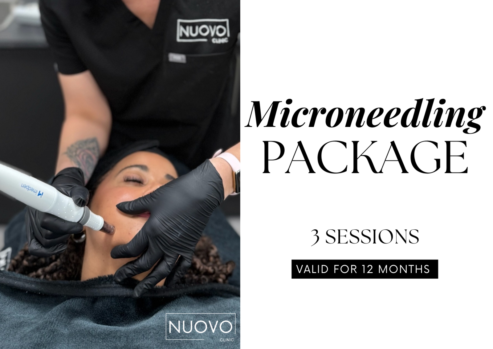 Microneedling Facial (3 Sessions)