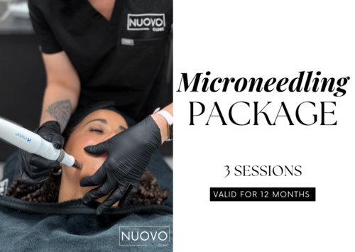 Microneedling Facial (3 Sessions)