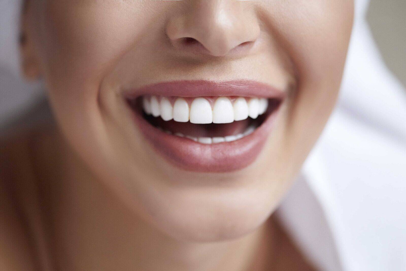 Zahnbleaching für ein atemberaubendes Lächeln 