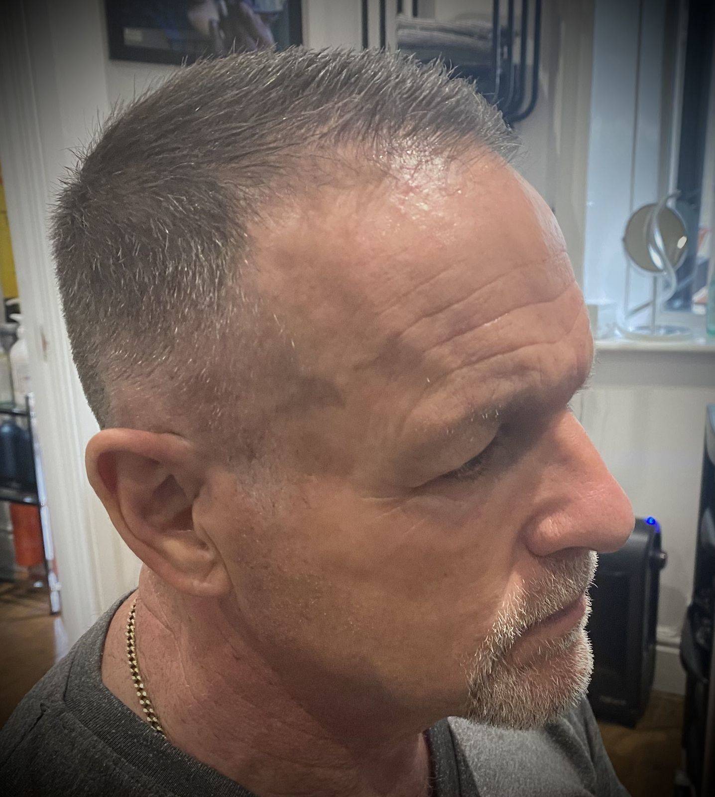 Grey blending - after 