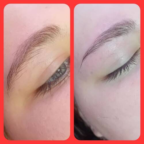 Brow reshape 
