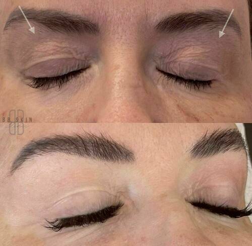 Louise/bbskin clinic/blush brow studio