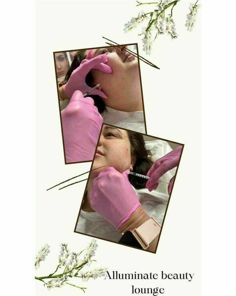 Masseters