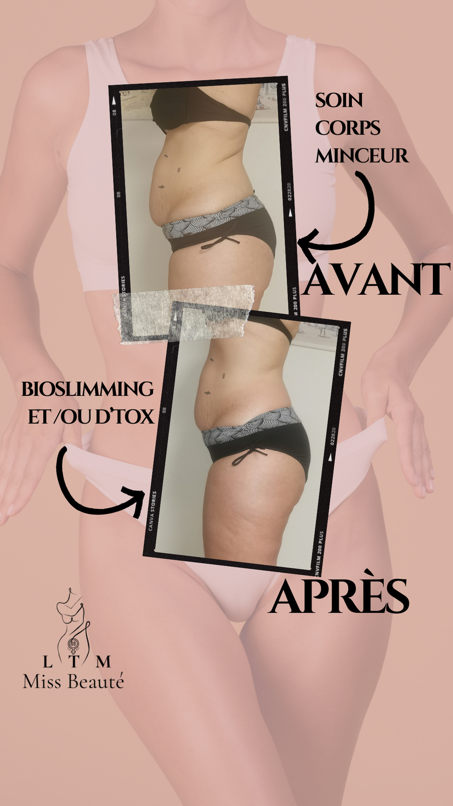 Bioslimming