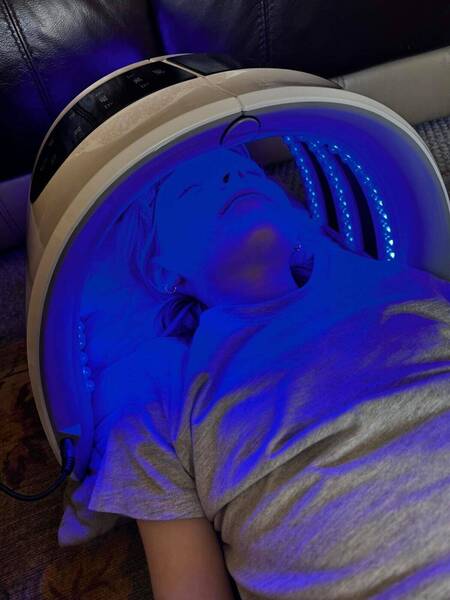 LED light therapy treatment 