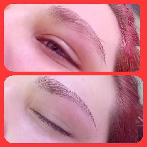 Brow reshape 