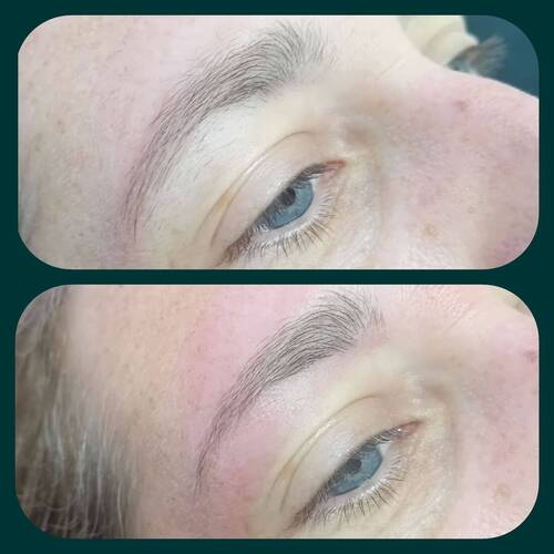 Brow reshape 