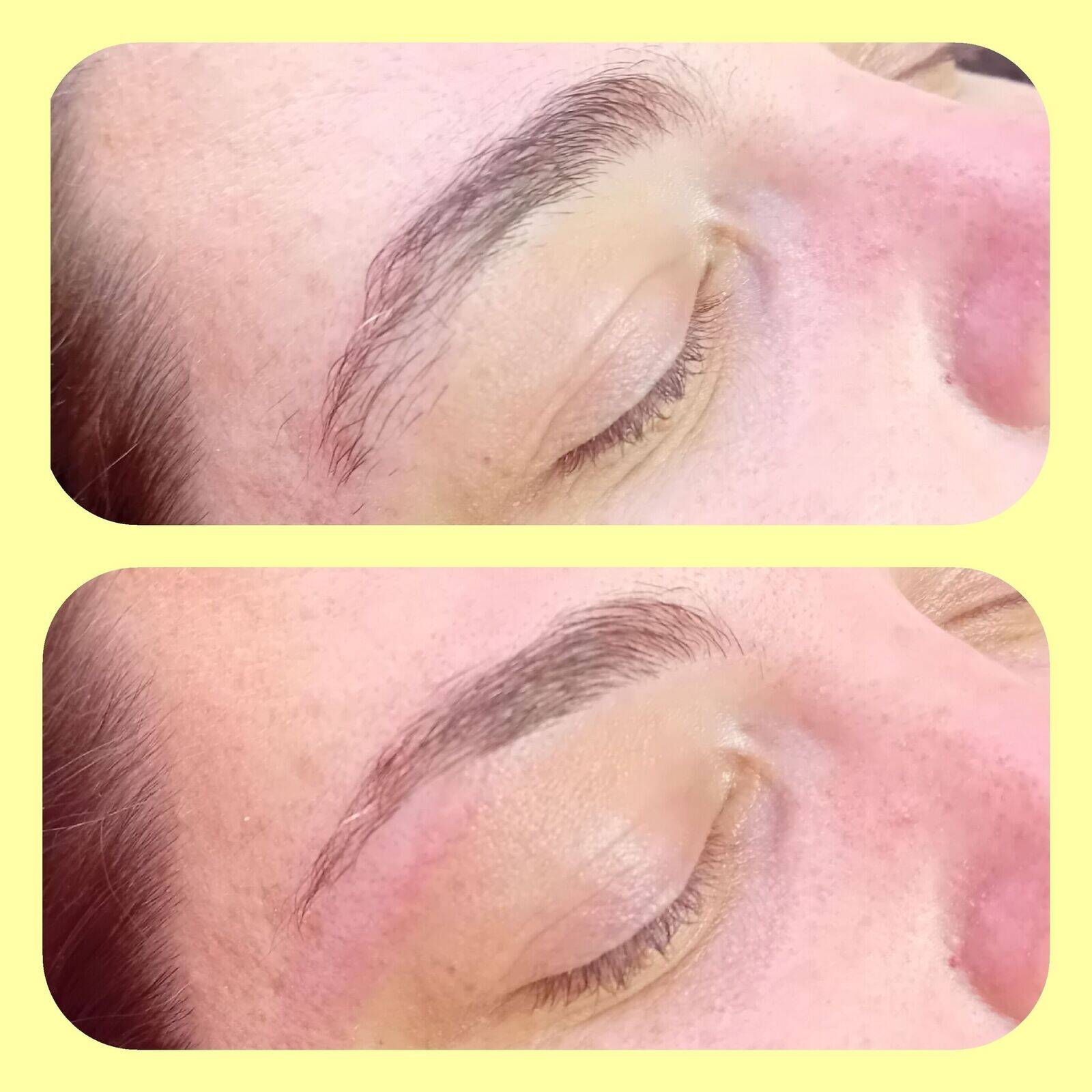 Brow reshape 
