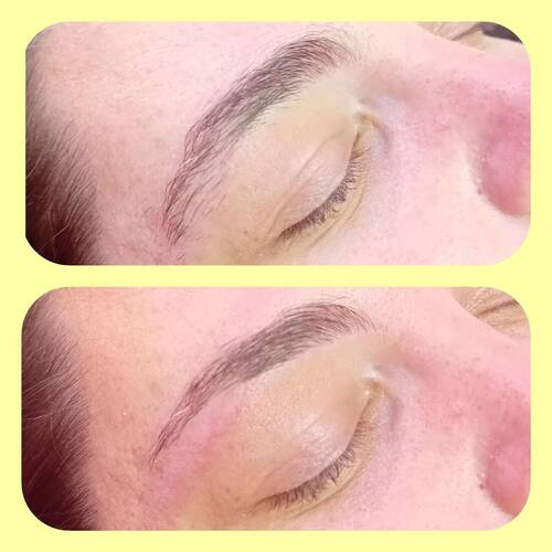 Brow reshape 