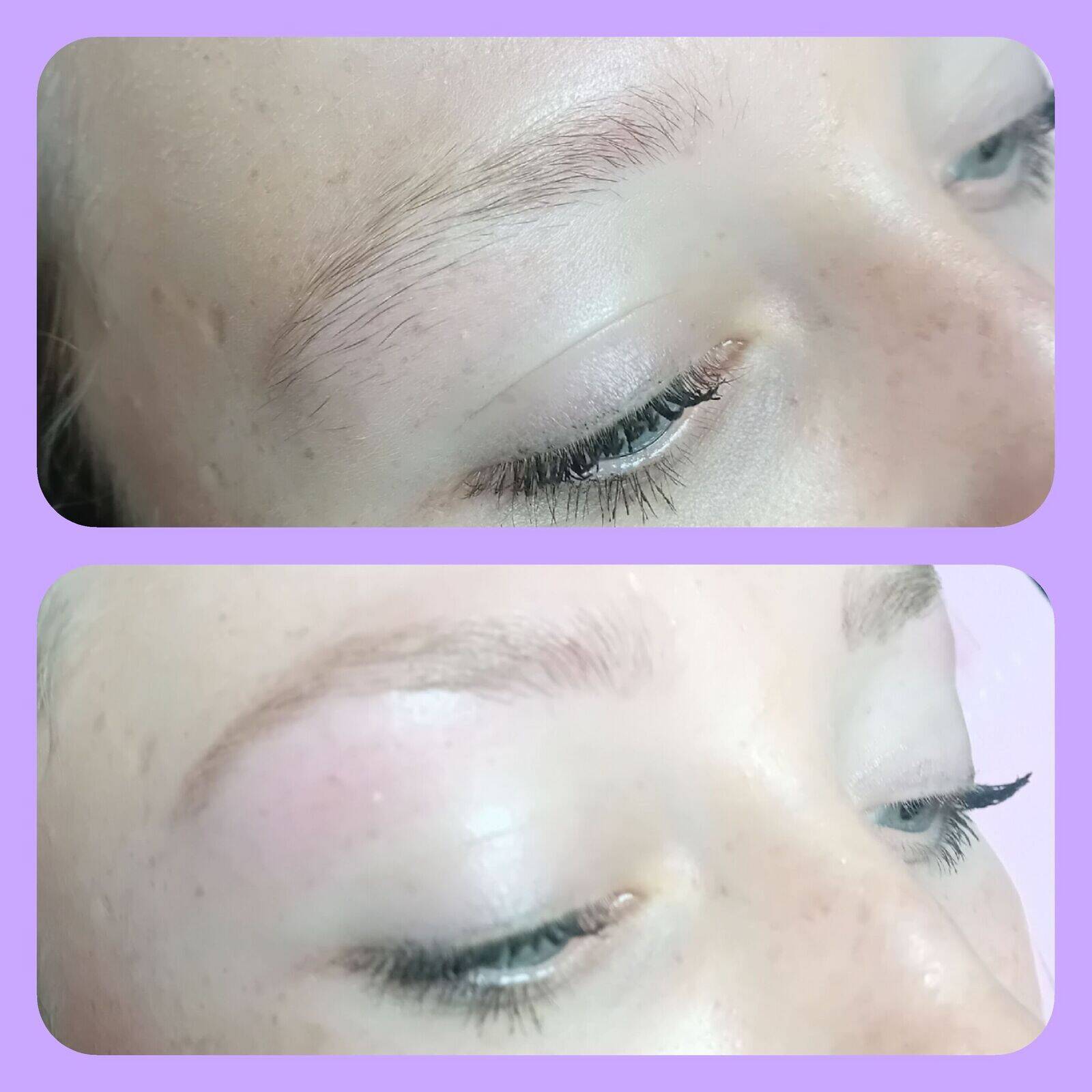 Brow reshape 