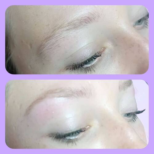 Brow reshape 