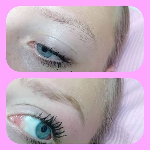 Brow reshape 