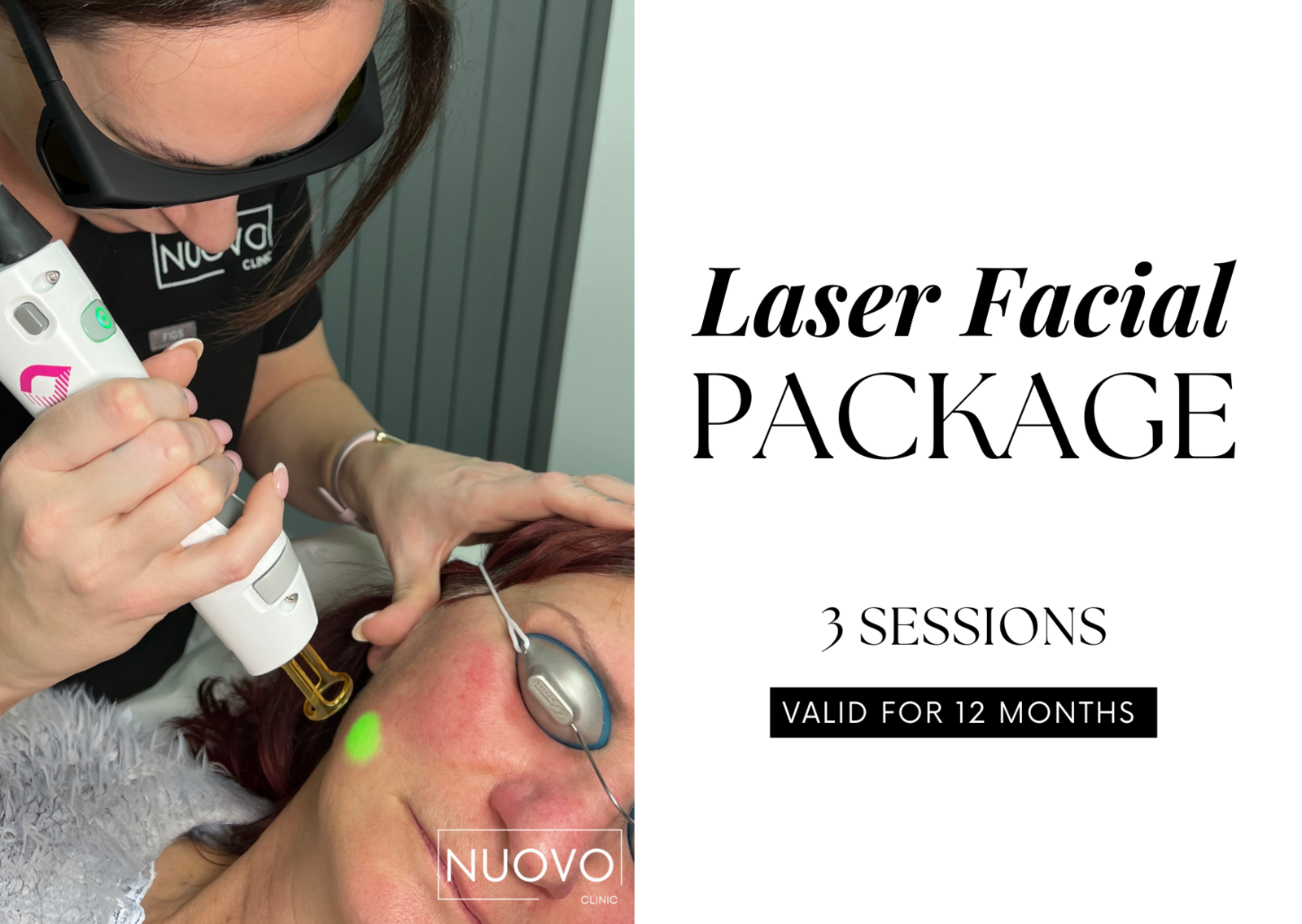 Laser Facial (3 Sessions)