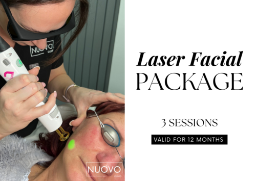 Laser Facial (3 Sessions)