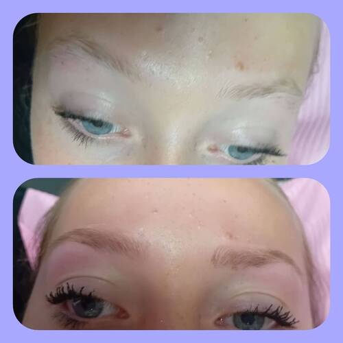 Brow reshape 