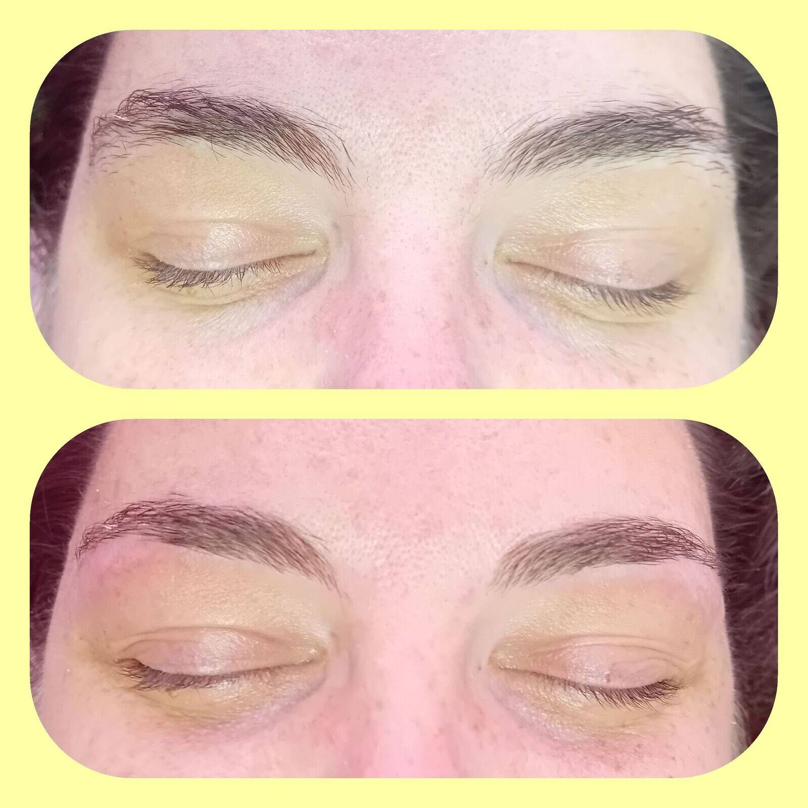 Brow reshape 