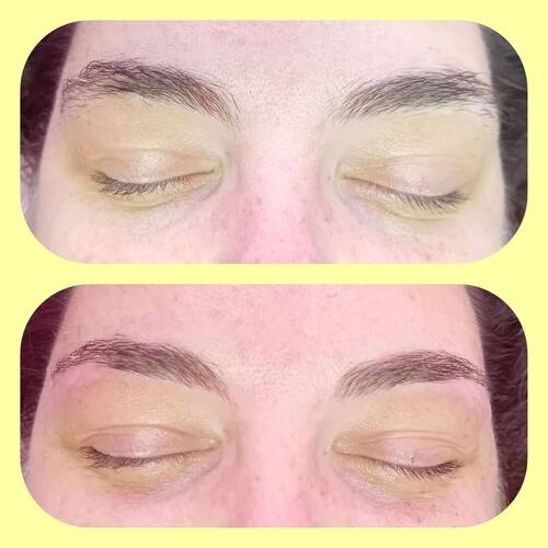 Brow reshape 