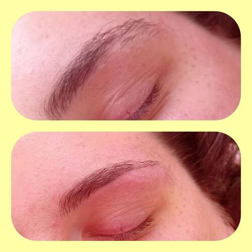 Brow reshape 