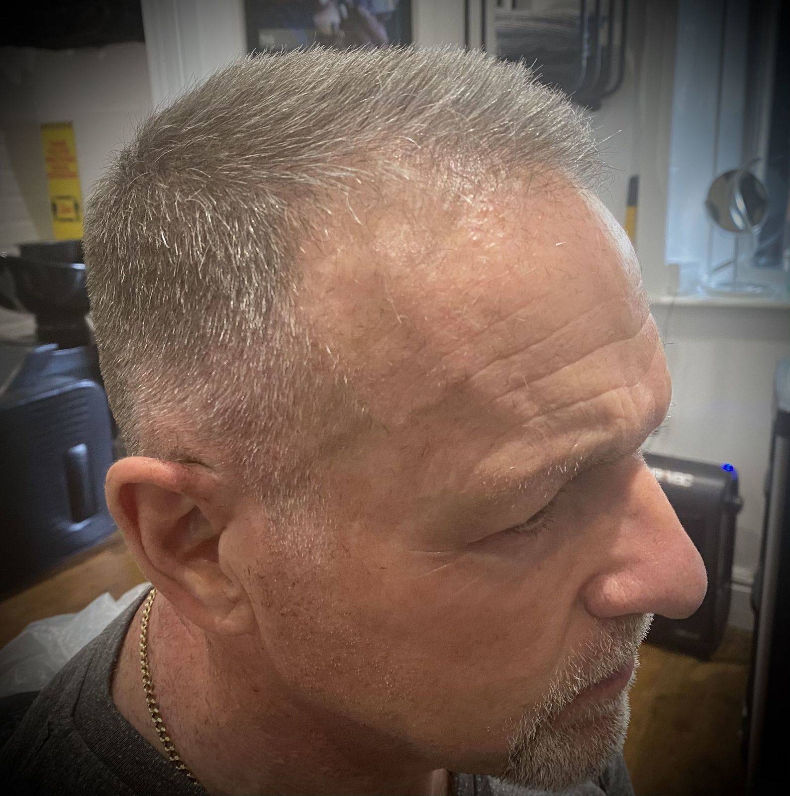 Grey blending - before