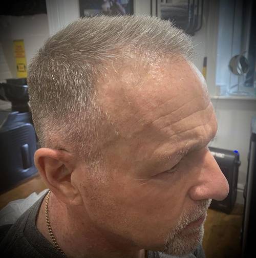 Grey blending - before