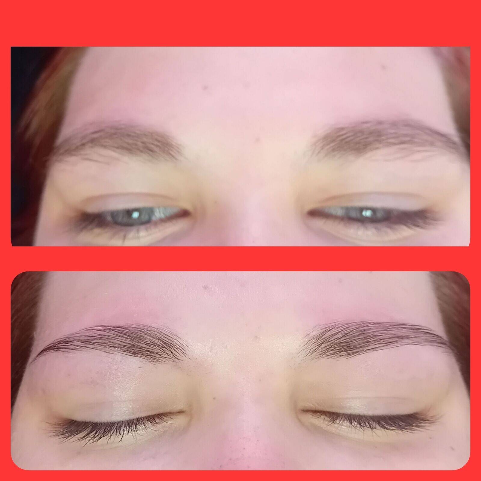 Brow reshape 