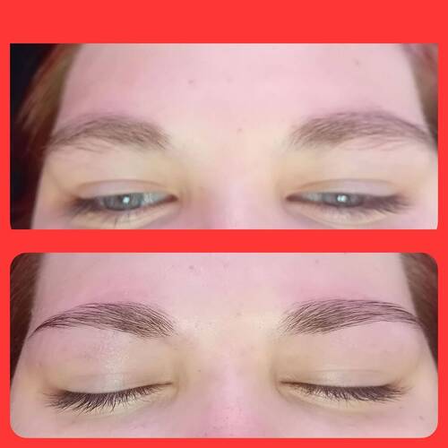 Brow reshape 